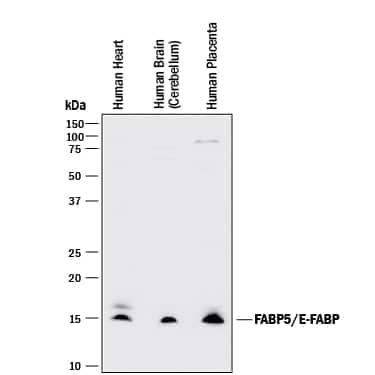 FABP5 Antibody in Western Blot (WB)