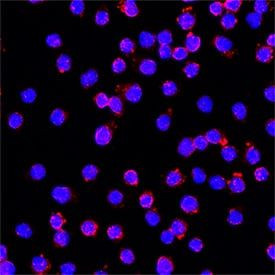 S100A10 Antibody in Immunocytochemistry (ICC/IF)