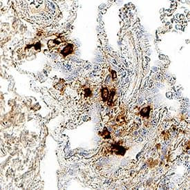 TPSB2 Antibody in Immunohistochemistry (Paraffin) (IHC (P))