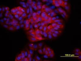 TSPAN8 Antibody in Immunocytochemistry (ICC/IF)