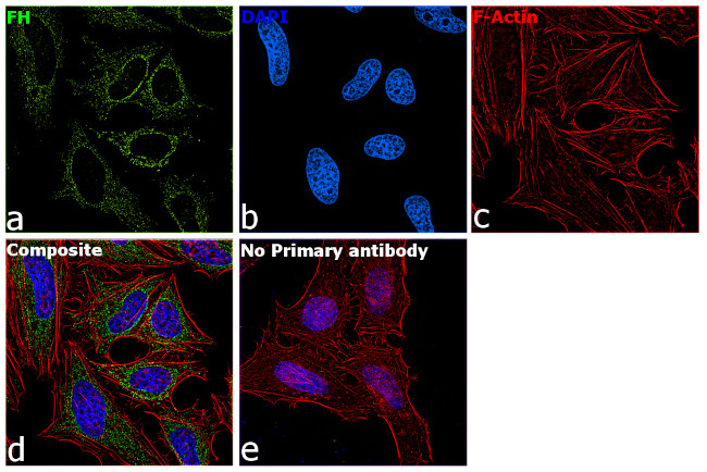 Fumarase Antibody in Immunocytochemistry (ICC/IF)