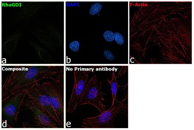 RhoGDI Antibody in Immunocytochemistry (ICC/IF)