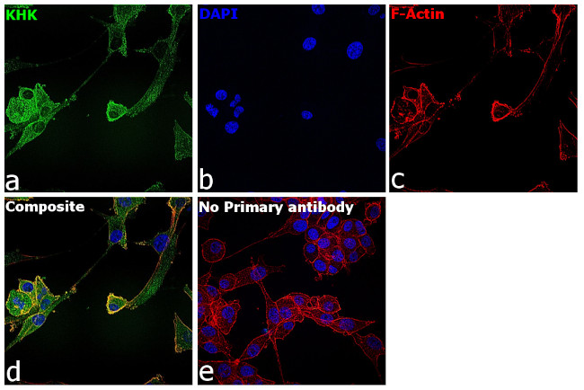 KHK Antibody in Immunocytochemistry (ICC/IF)