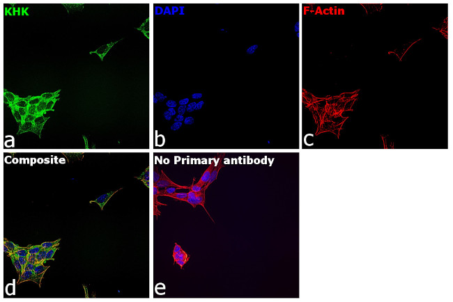 KHK Antibody in Immunocytochemistry (ICC/IF)