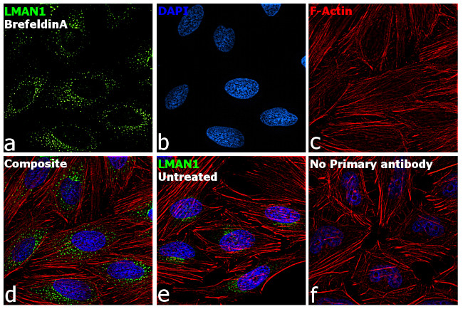 LMAN1 Antibody in Immunocytochemistry (ICC/IF)