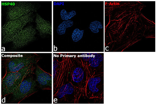 HSP40 Antibody in Immunocytochemistry (ICC/IF)