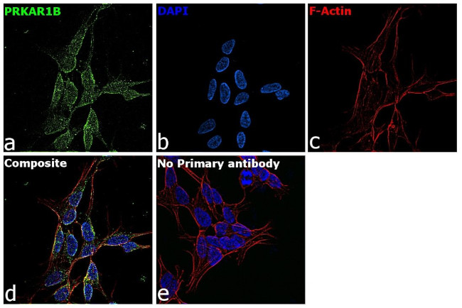 PRKAR1B Antibody in Immunocytochemistry (ICC/IF)