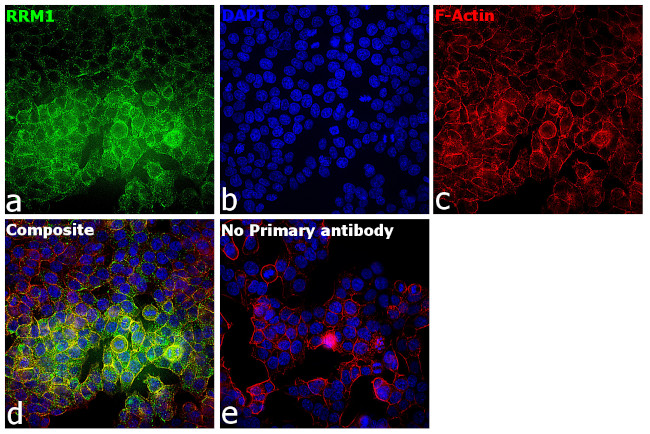 RRM1 Antibody in Immunocytochemistry (ICC/IF)