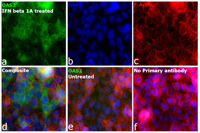 OAS2 Antibody in Immunocytochemistry (ICC/IF)