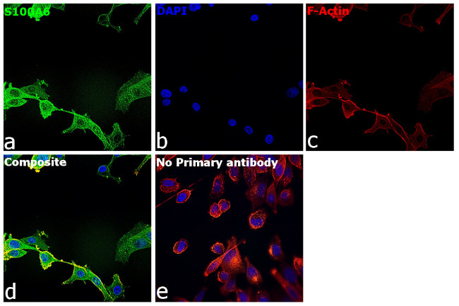 S100A6 Antibody in Immunocytochemistry (ICC/IF)