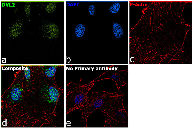 DVL2 Antibody in Immunocytochemistry (ICC/IF)