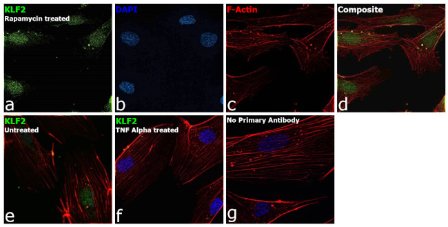 KLF2 Antibody in Immunocytochemistry (ICC/IF)
