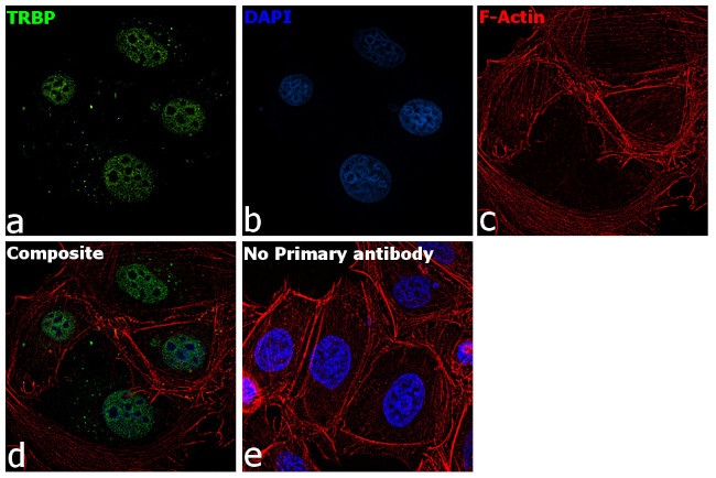 TRBP Antibody in Immunocytochemistry (ICC/IF)