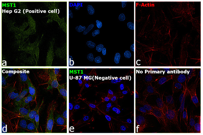 MSP Antibody in Immunocytochemistry (ICC/IF)