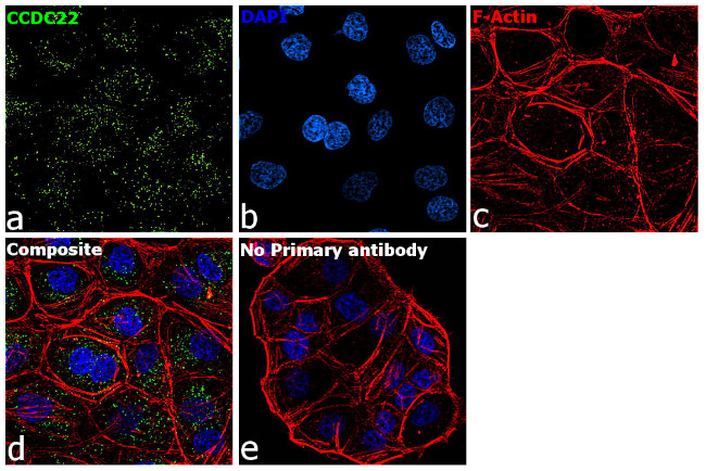 CCDC22 Antibody in Immunocytochemistry (ICC/IF)