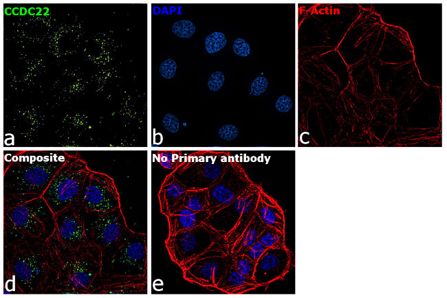CCDC22 Antibody in Immunocytochemistry (ICC/IF)