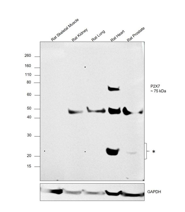 P2X7 Antibody in Western Blot (WB)