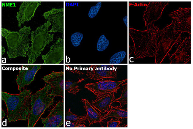 NME1 Antibody in Immunocytochemistry (ICC/IF)
