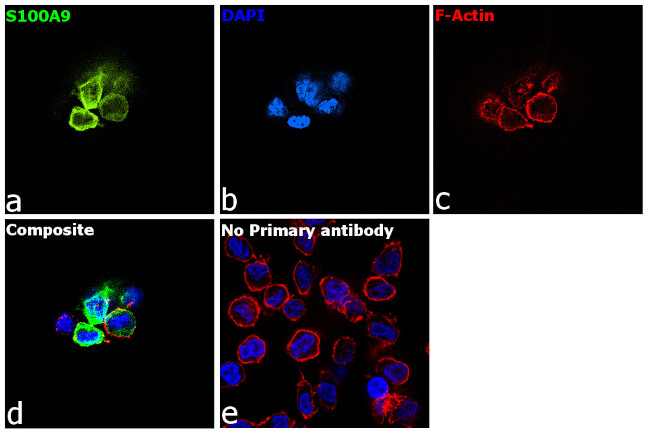 S100A9 Antibody in Immunocytochemistry (ICC/IF)