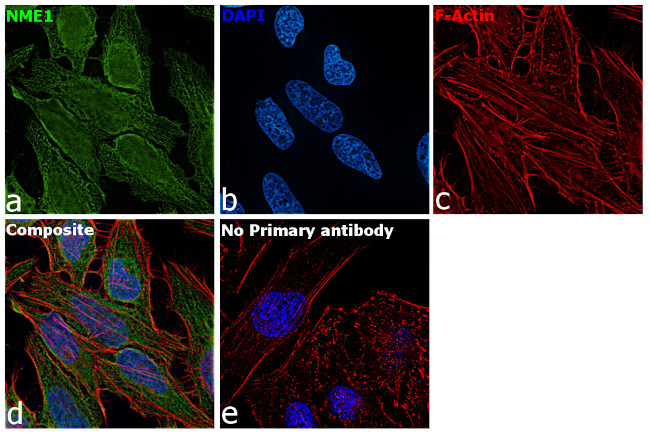 NME1 Antibody in Immunocytochemistry (ICC/IF)