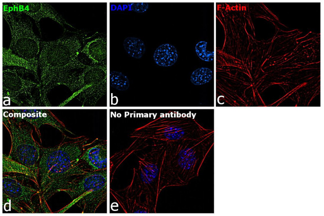 EphB4 Antibody in Immunocytochemistry (ICC/IF)