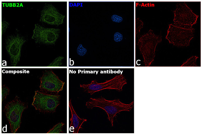 TUBB2A Antibody in Immunocytochemistry (ICC/IF)