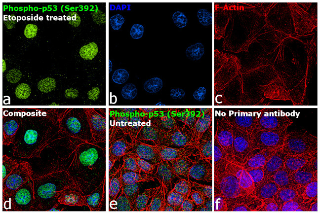 Phospho-p53 (Ser392) Antibody in Immunocytochemistry (ICC/IF)