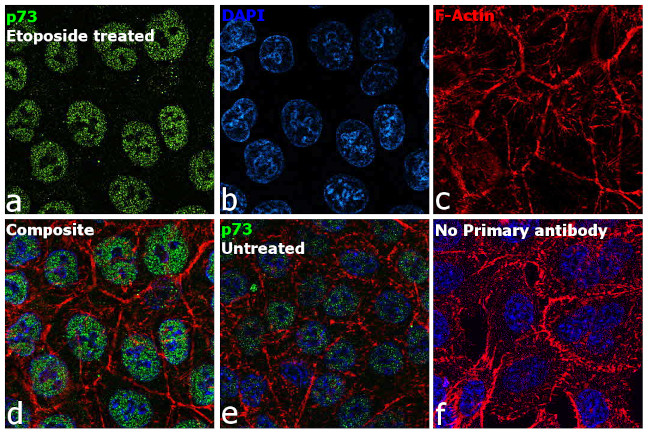 p73 Antibody in Immunocytochemistry (ICC/IF)