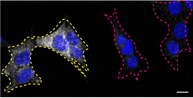 TSC2 Antibody in Immunocytochemistry (ICC/IF)