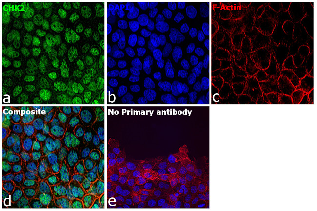 CHK2 Antibody in Immunocytochemistry (ICC/IF)