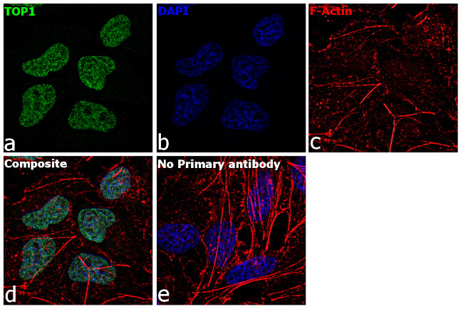 TOP1 Antibody in Immunocytochemistry (ICC/IF)
