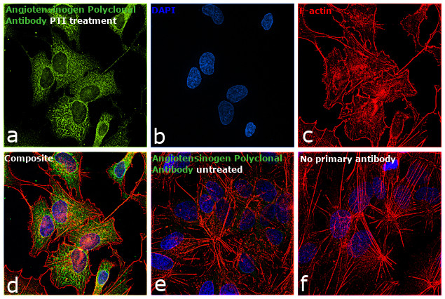 Angiotensinogen Antibody in Immunocytochemistry (ICC/IF)