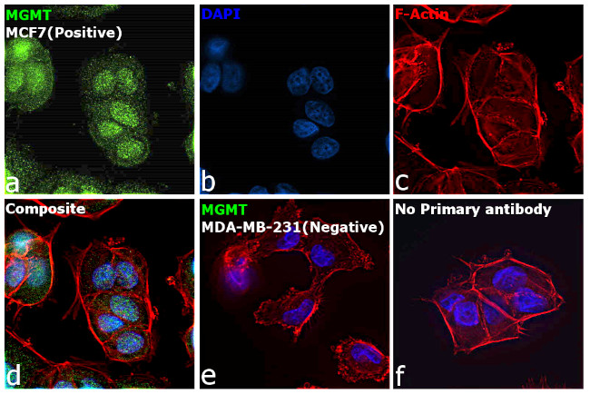 MGMT Antibody in Immunocytochemistry (ICC/IF)