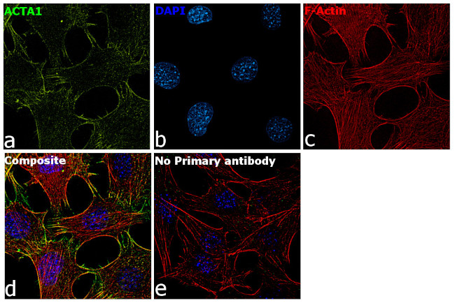 Actin Antibody in Immunocytochemistry (ICC/IF)