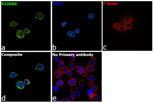 S100A9 Antibody in Immunocytochemistry (ICC/IF)
