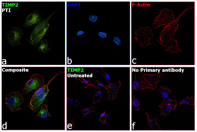 TIMP2 Antibody in Immunocytochemistry (ICC/IF)