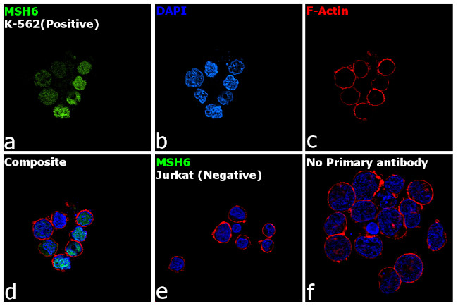 MSH6 Antibody in Immunocytochemistry (ICC/IF)