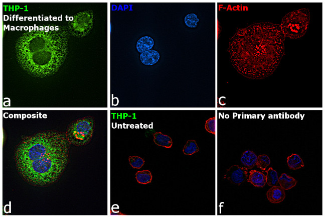 MMP9 Antibody in Immunocytochemistry (ICC/IF)