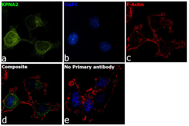 KPNA2 Antibody in Immunocytochemistry (ICC/IF)