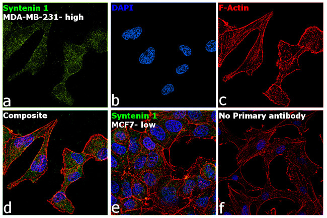 Syntenin 1 Antibody in Immunocytochemistry (ICC/IF)