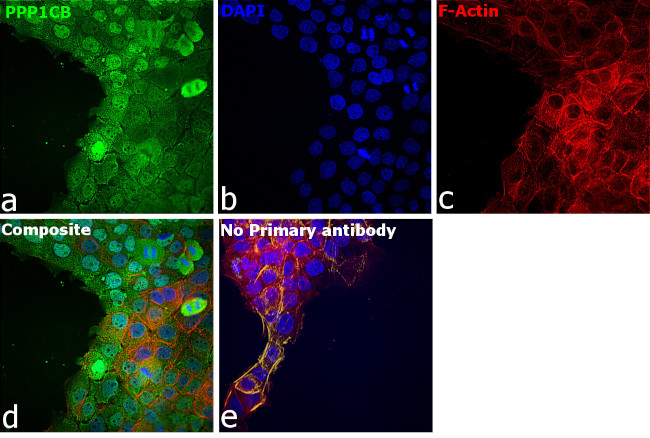 PP1 beta Antibody in Immunocytochemistry (ICC/IF)