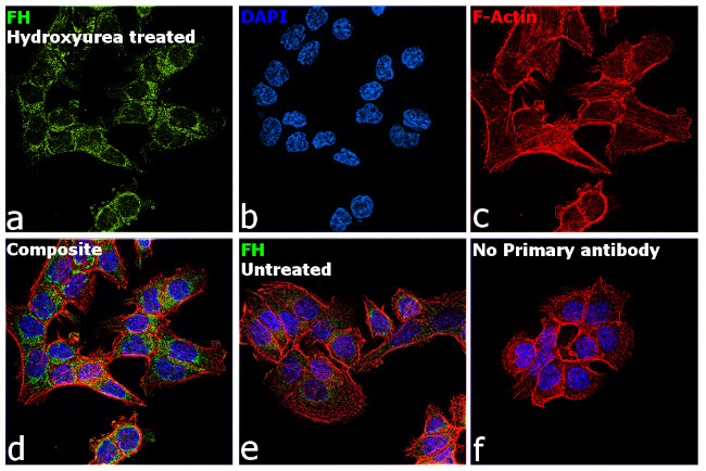 Fumarase Antibody in Immunocytochemistry (ICC/IF)