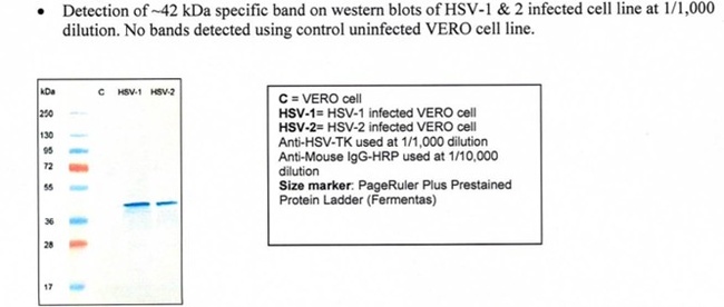 Herpes Simplex Virus Type 1/2 TK Antibody in Western Blot (WB)