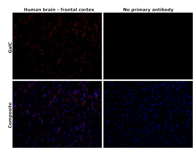 GALC Antibody in Immunohistochemistry (Paraffin) (IHC (P))