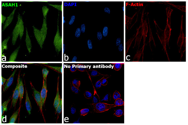 ASAH1 Antibody in Immunocytochemistry (ICC/IF)
