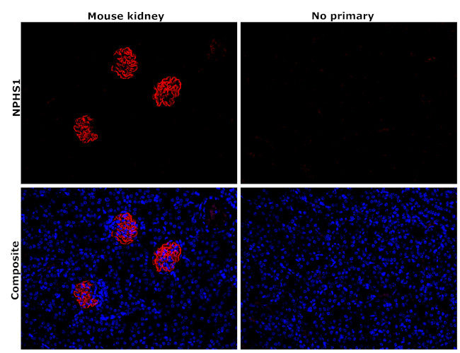 Nephrin Antibody in Immunohistochemistry (Paraffin) (IHC (P))