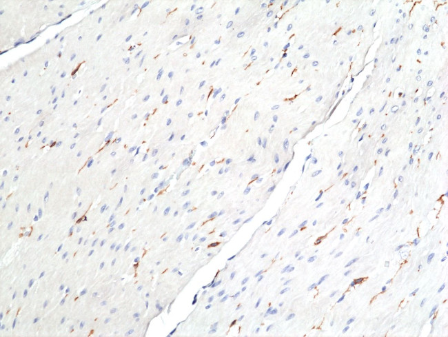 DOG-1 Antibody in Immunohistochemistry (Paraffin) (IHC (P))