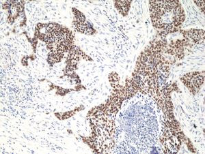p40 (DeltaNp63) Antibody in Immunohistochemistry (Paraffin) (IHC (P))