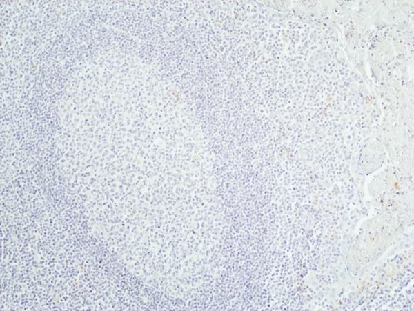 CDX2 Antibody in Immunohistochemistry (Paraffin) (IHC (P))
