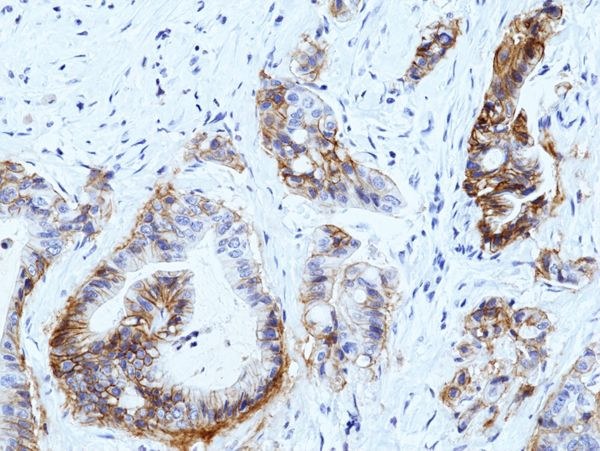 Claudin 18.2 Antibody in Immunohistochemistry (Paraffin) (IHC (P))